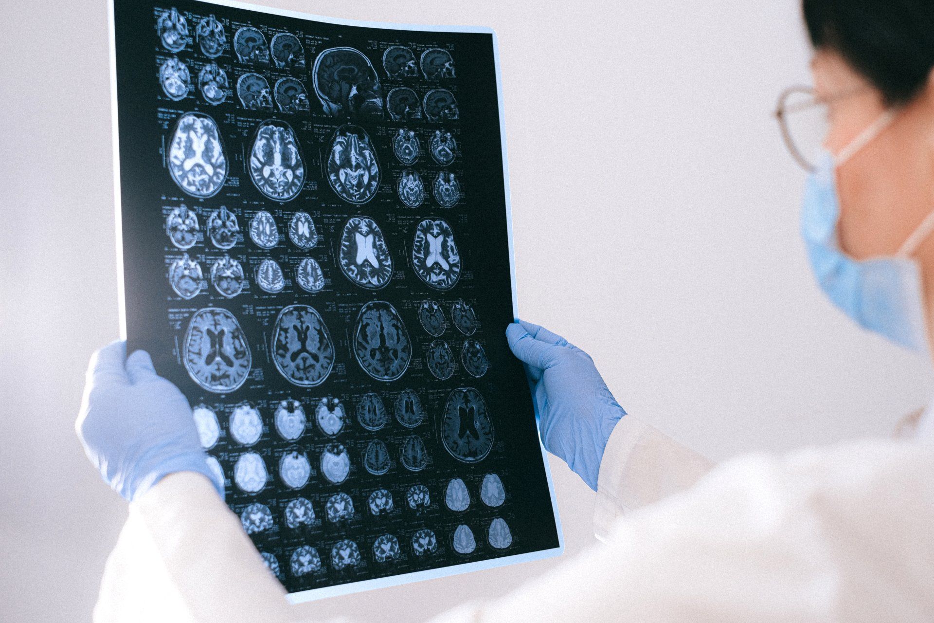 Brain MRI scan for headaches