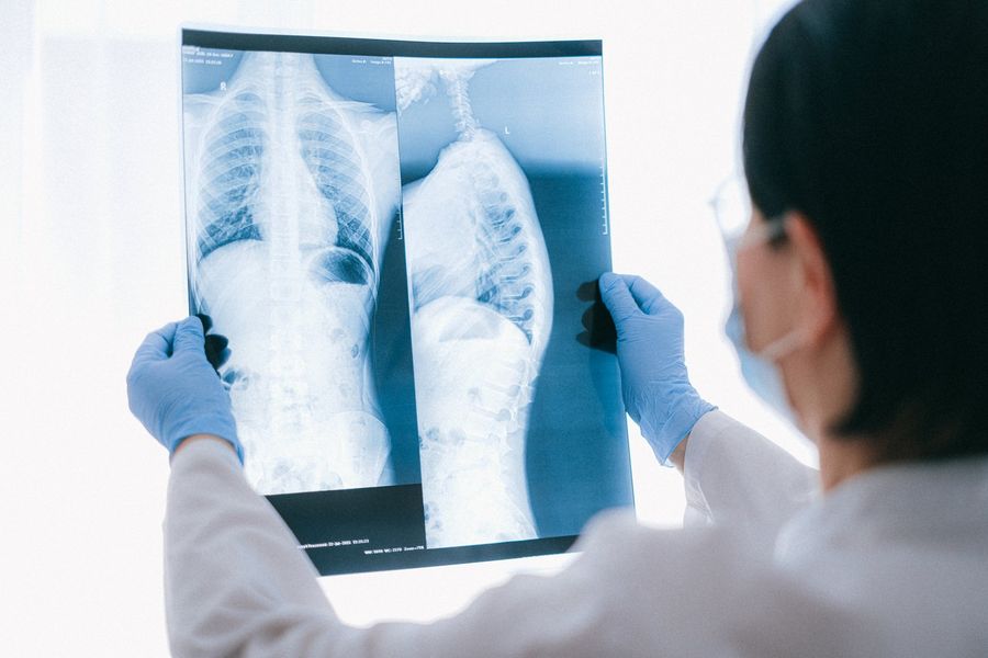 A doctor is looking at an x-ray of a person 's chest.