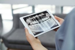 a person is holding a tablet with an x-ray of their teeth on it .