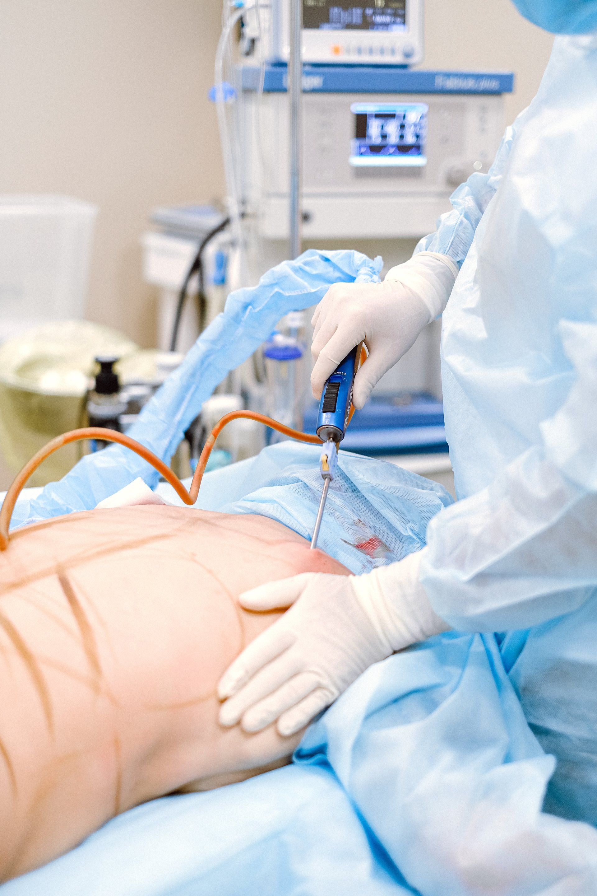 Laparoscopic Surgery in Buffalo, NY