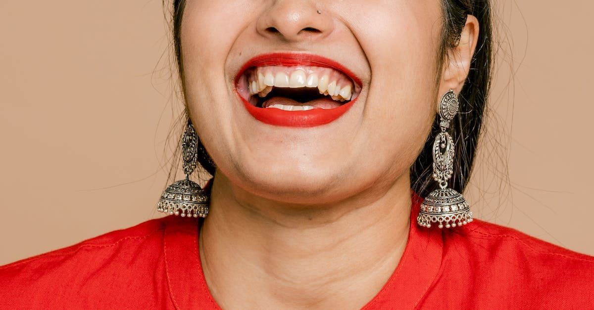 woman-laughing-after-teeth-whitening