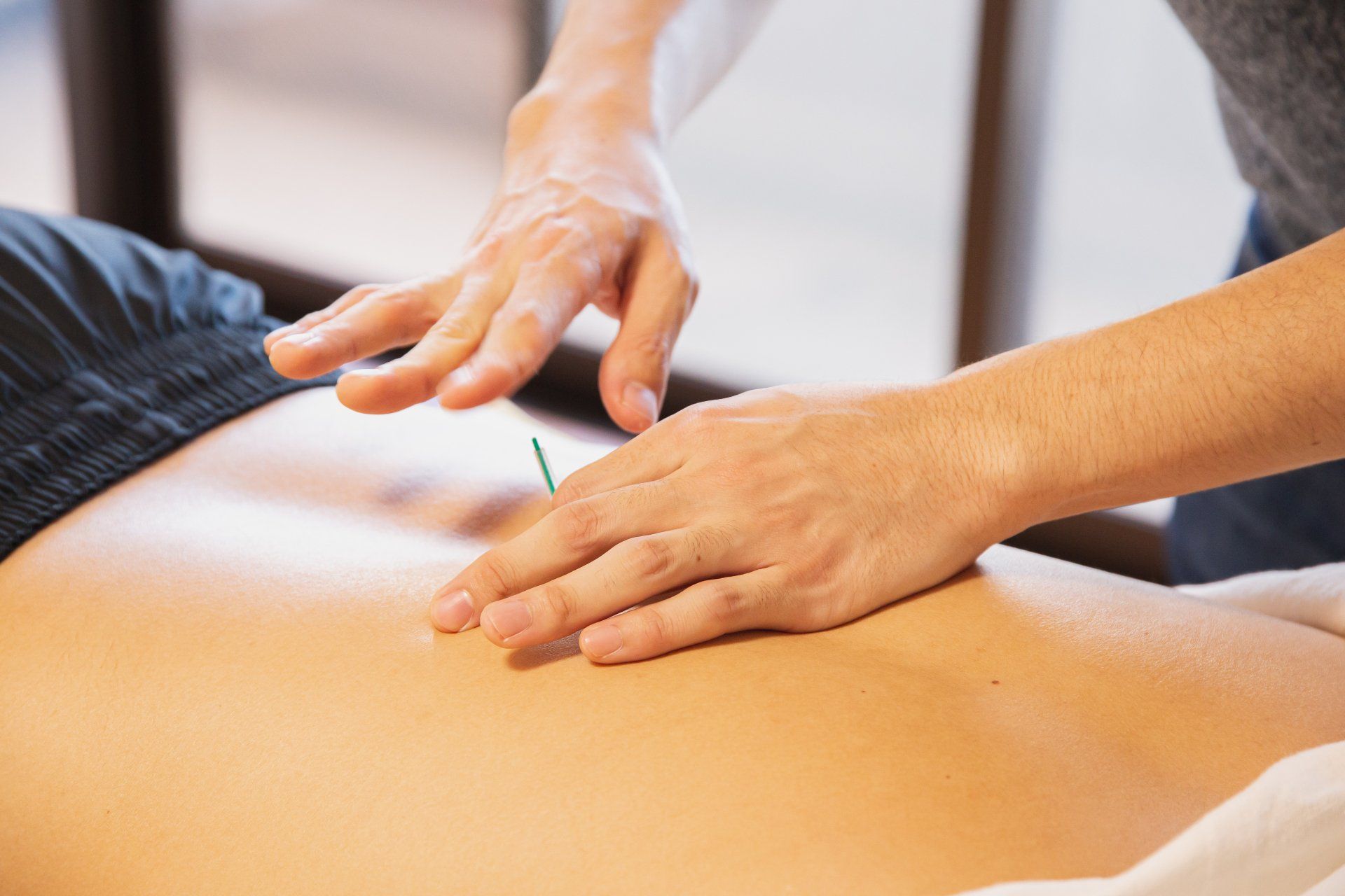 Acupuncture with Electro-Stimulation in Santa Monica/Los Angeles