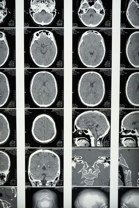 diagnostica per immagini del cervello