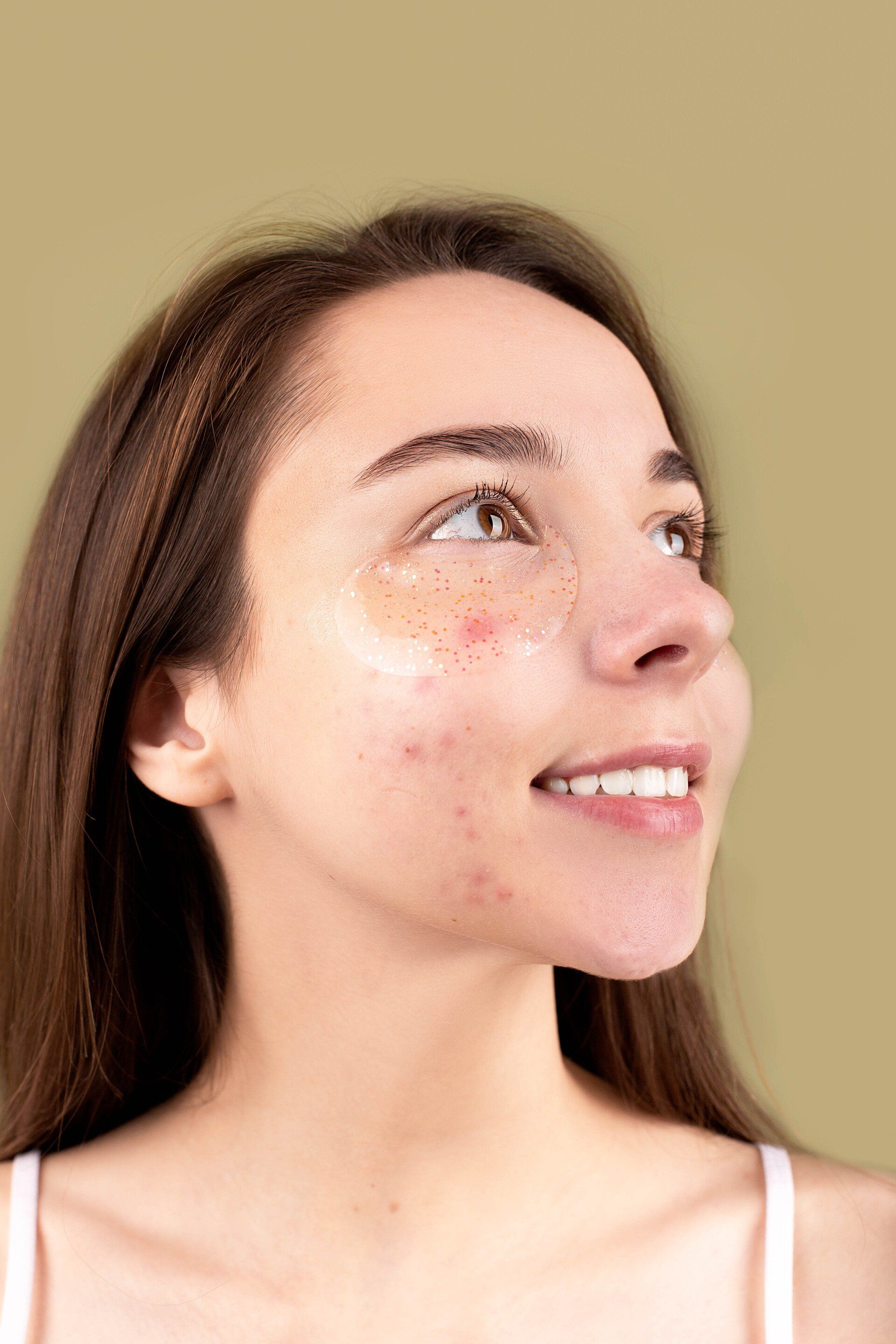 A woman with acne on her face is smiling and looking up.