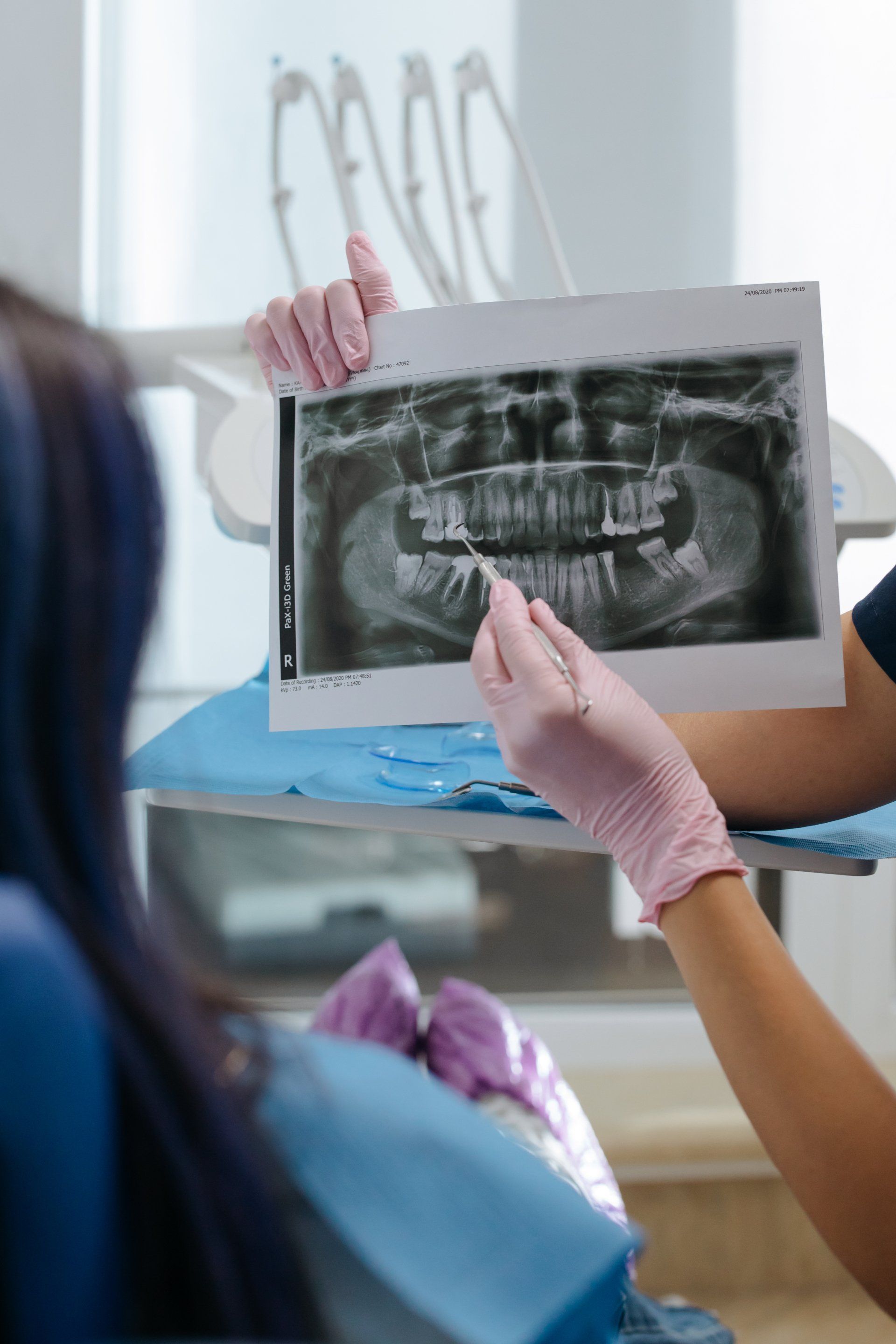 een vrouw zit in een tandartsstoel en kijkt naar een röntgenfoto van haar tanden.