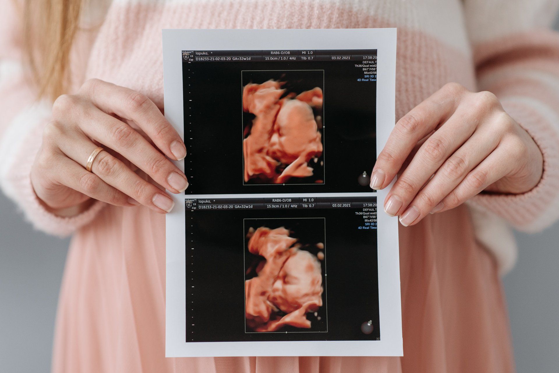Woman holding an ultrasound printout
