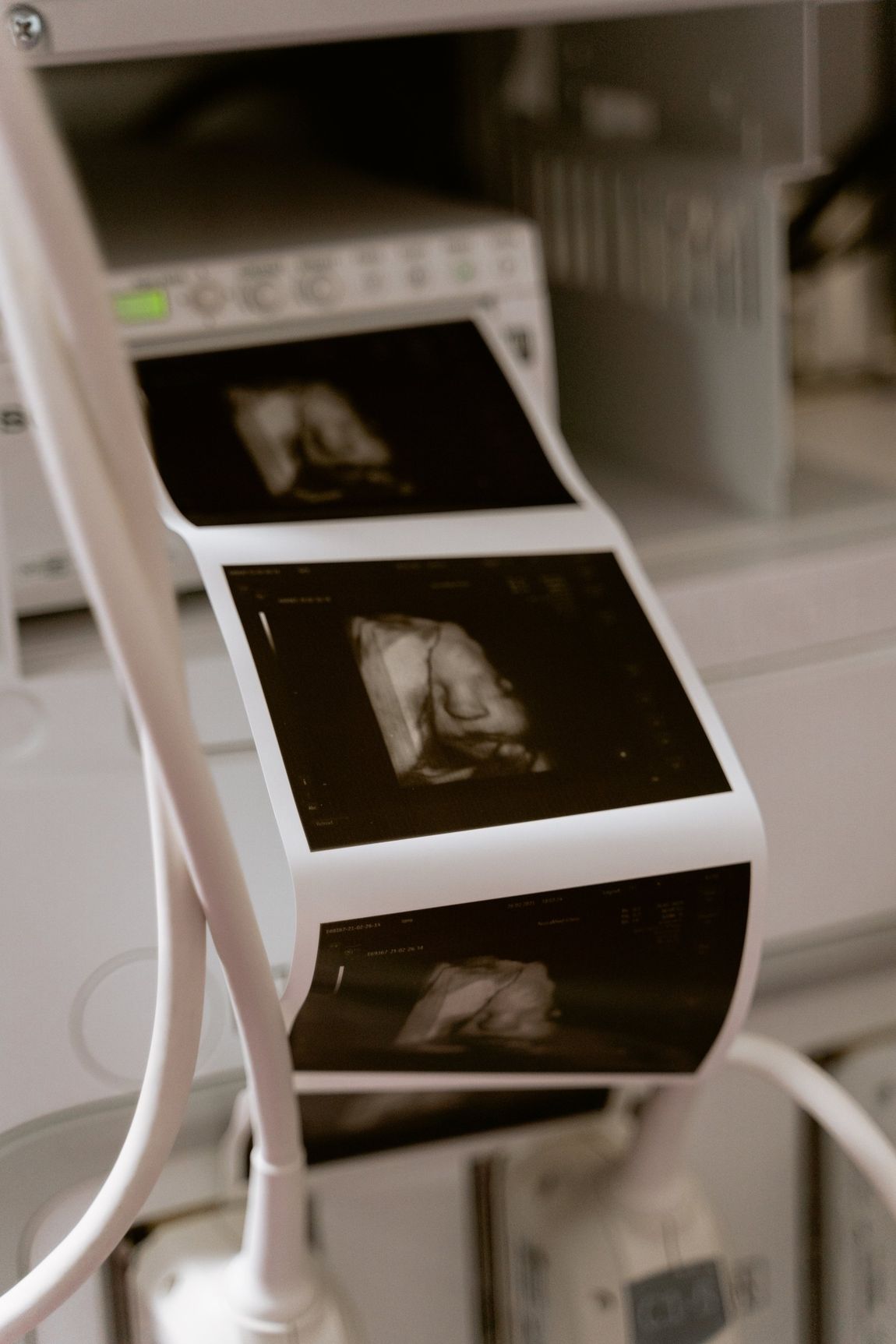 A close up of an ultrasound machine with a bunch of pictures on it