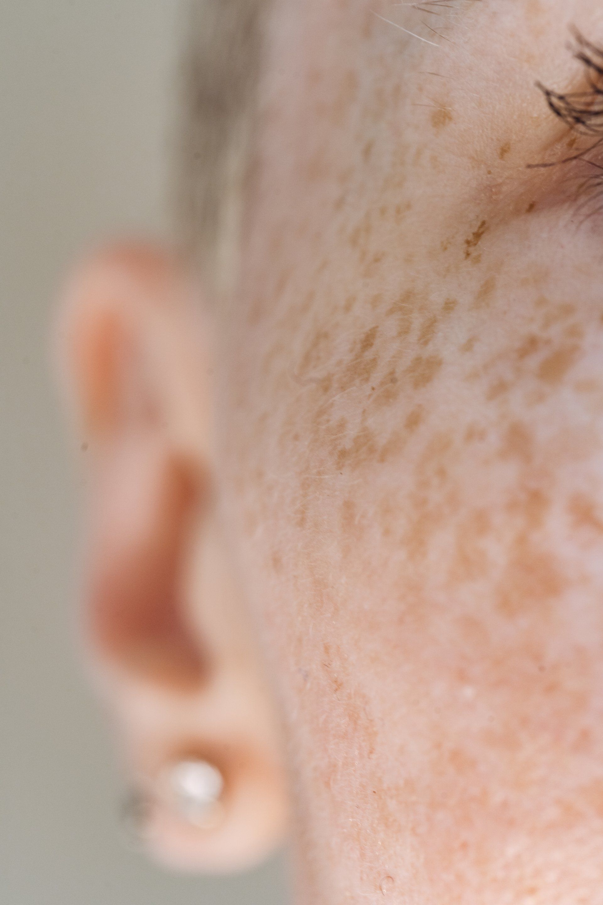 a close up shot of someone's  freckles and earrings