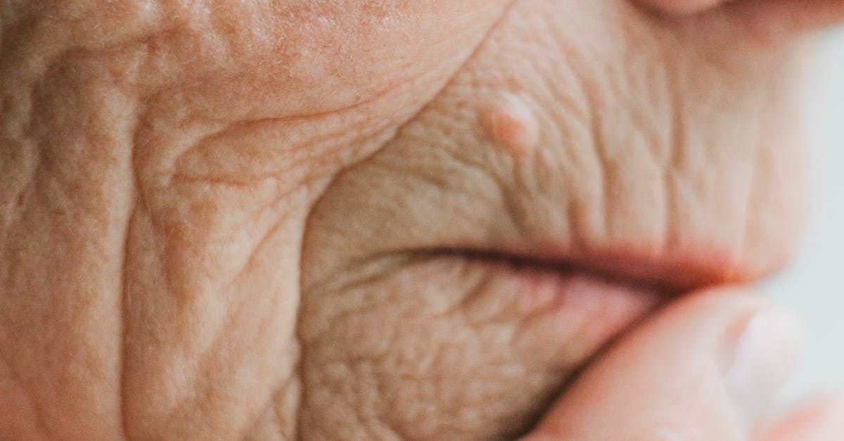 Skin wrinkles around the mouth, lips nose and cheek caused by aging or sun exposure