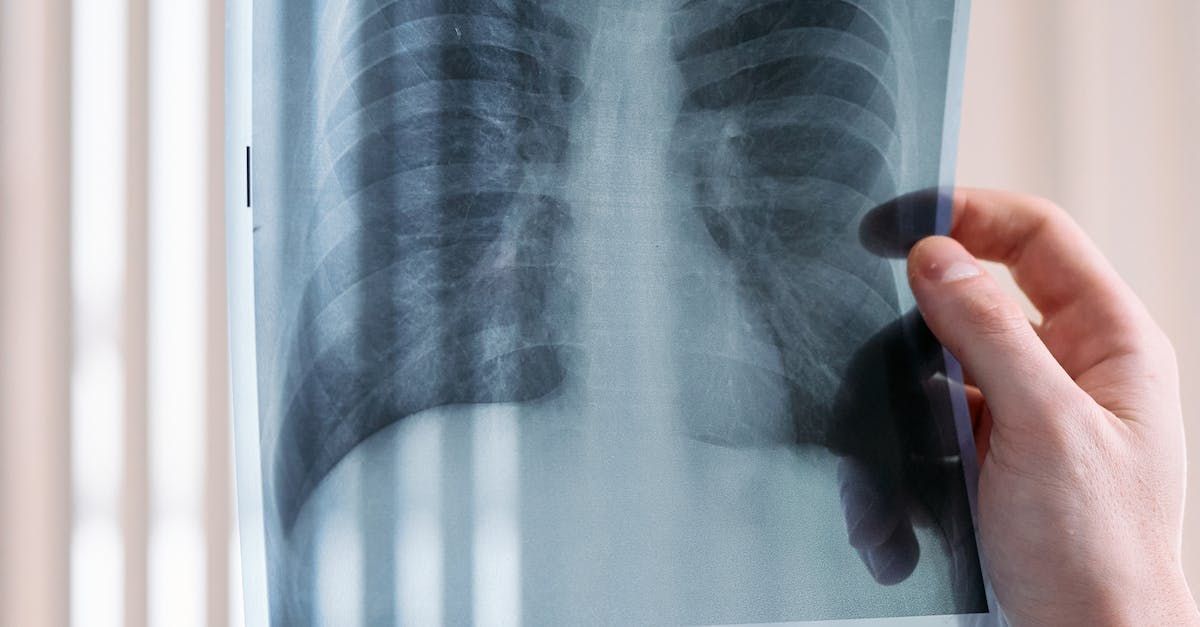A person is holding an x-ray of their lungs.