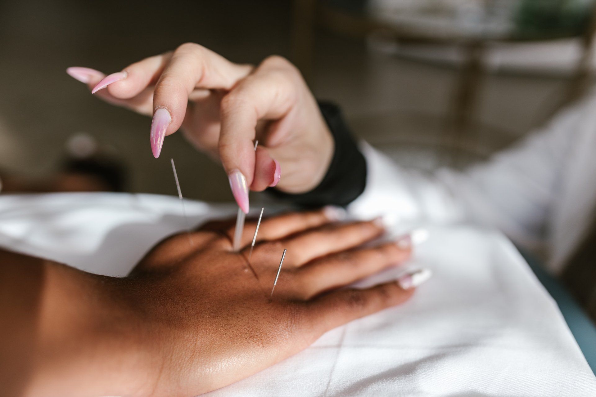 A woman with long nails is getting acupuncture on her hand.