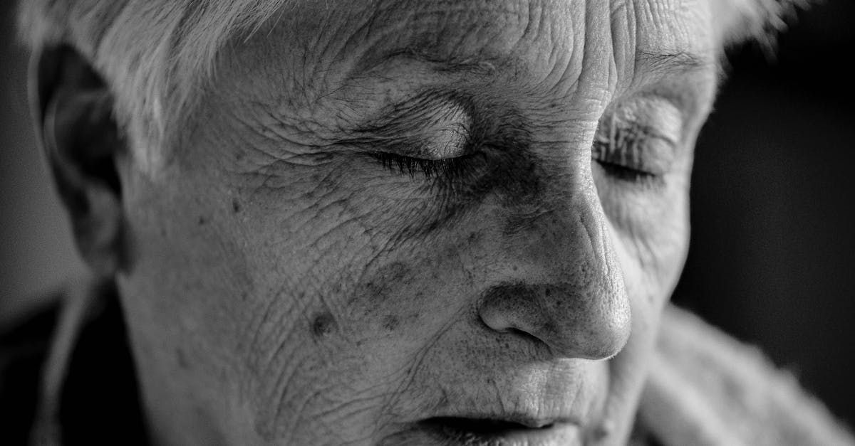 A ladies face showing deep lines a wrinkles due to the signs of ageing and exposure to the sun over many years.