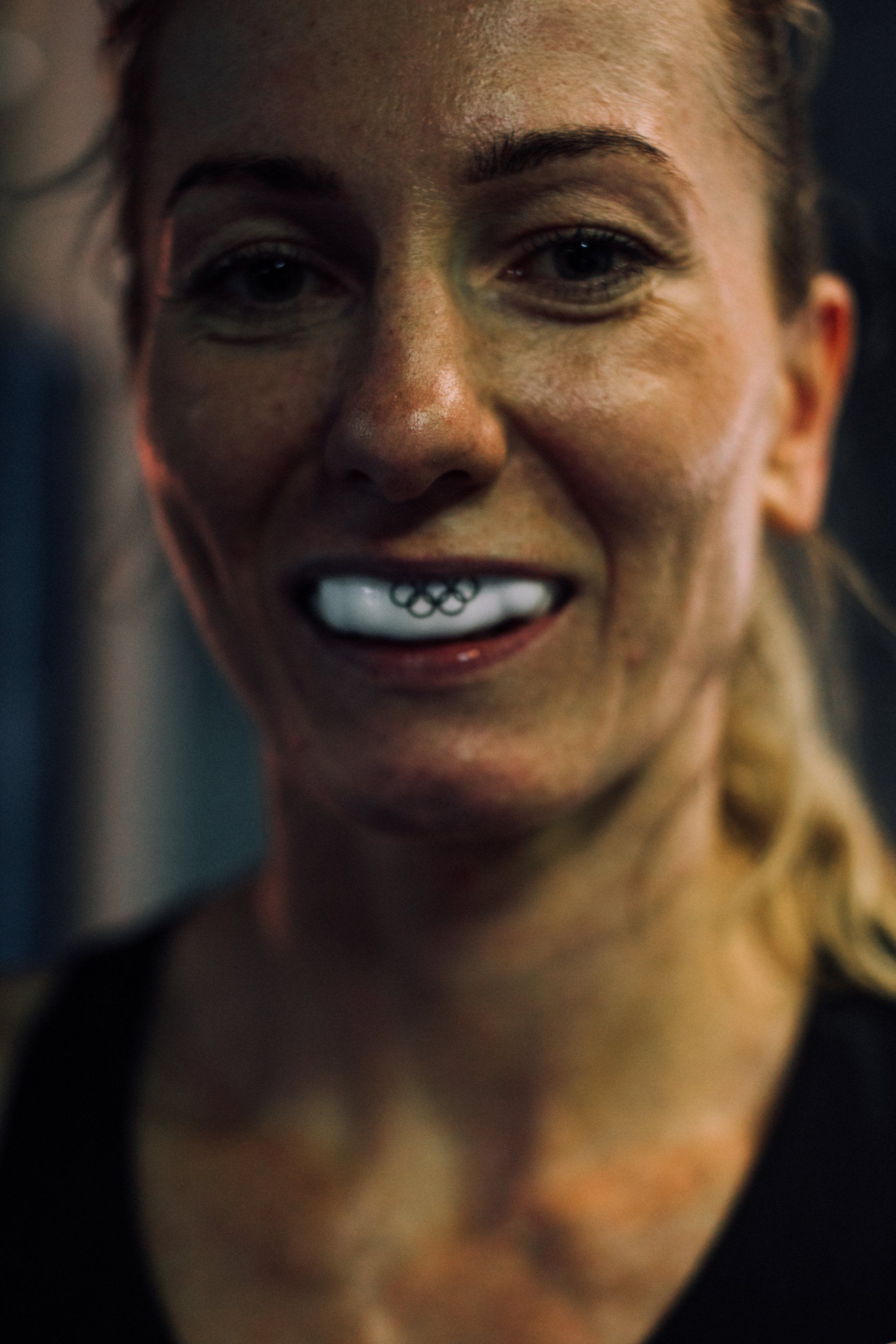 Mouth Guards: When and Why You Need One