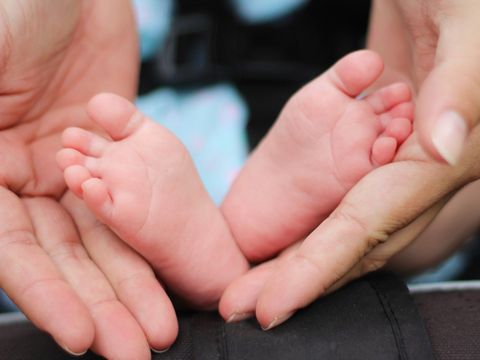 Clubfoot Treatment