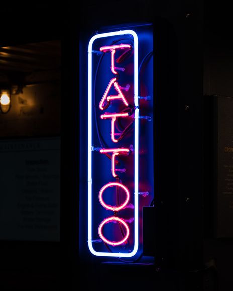 What does tattoo removal feel like? | Tattoo Neon Sign