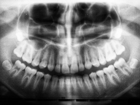 panoramica digitale arcate dentarie