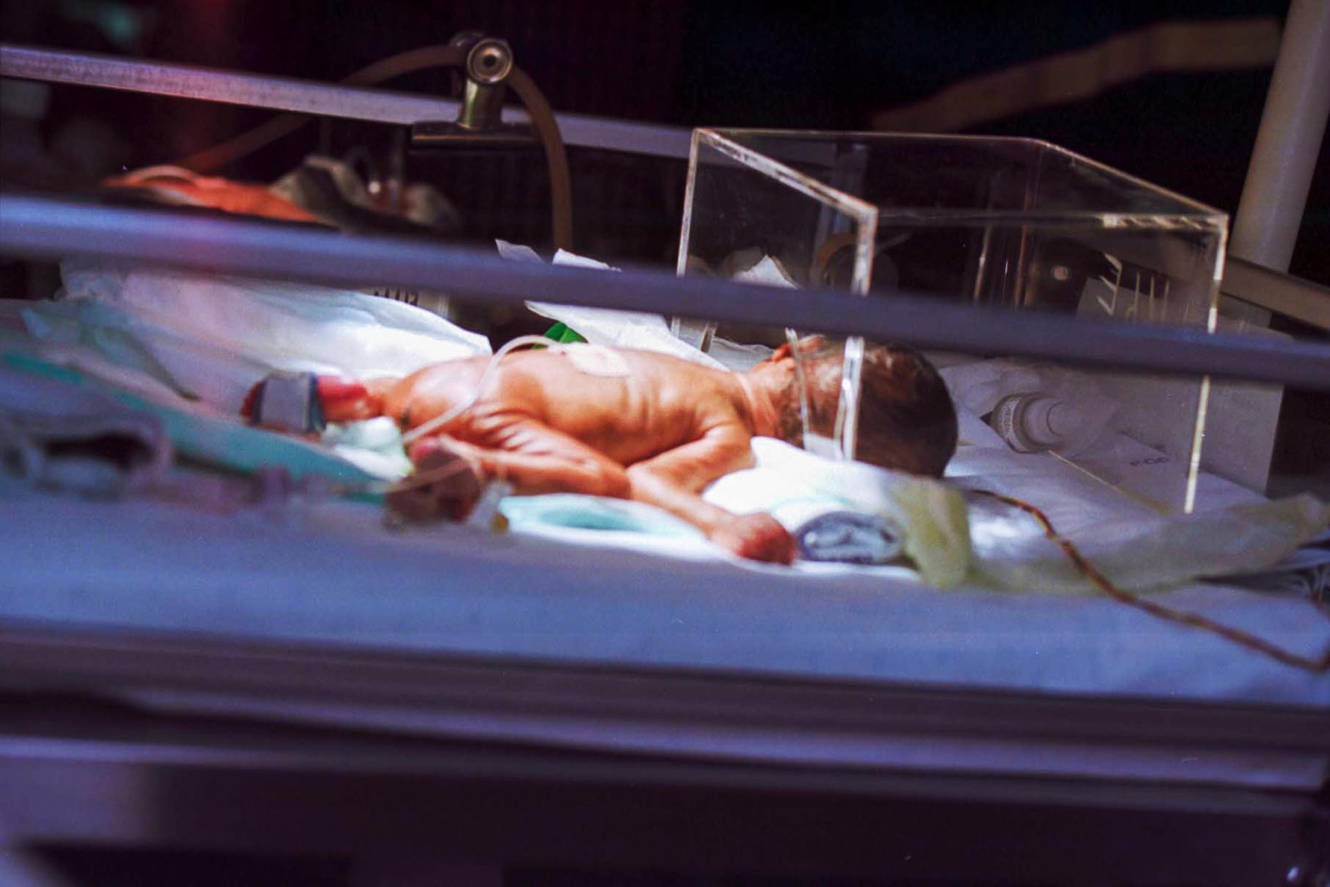 A baby is laying in an incubator in a hospital.